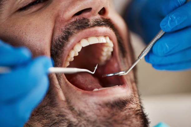 Best Emergency Wisdom Tooth Extraction in El Paso, TX